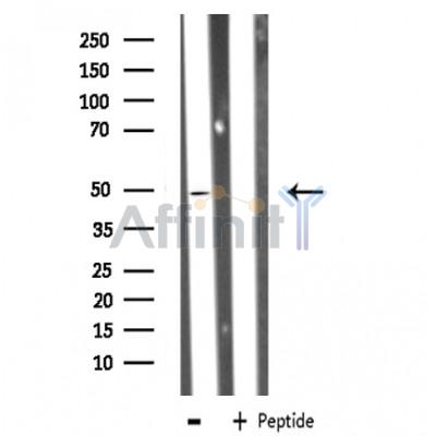 ZNF436 Antibody - Western blot analysis of extracts from HeLa cells, using ZNF436 antibody.