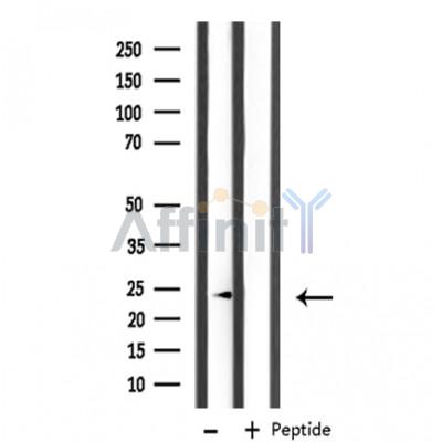 MRPL11 Antibody - Western blot analysis of extracts from COS cells, using MRPL11 antibody.