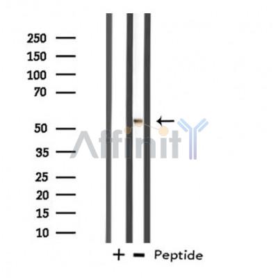 DDX19B Antibody - Western blot analysis of extracts from HT-29 cells, using DDX19B antibody.