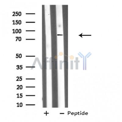 DDX50 Antibody - Western blot analysis of DDX50 expression in Mouse lung lysates .