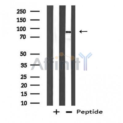 DDX54 Antibody - Western blot analysis of extracts from CoLo cells using DDX54 antibody.