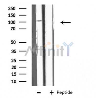 EPB41L2 Antibody - Western blot analysis of extracts from K562 cells, using EPB41L2 antibody.