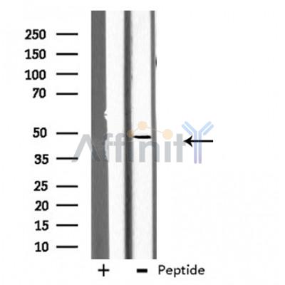 GCNT7 Antibody - Western blot analysis of extracts from K562 cells, using GCNT7 antibody.