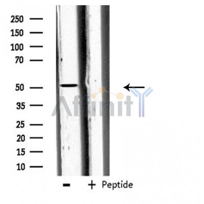 CPA5 Antibody - Western blot analysis of extracts from 293 cells, using CPA5 antibody.