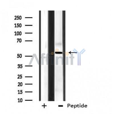 CPN2 Antibody - Western blot analysis of extracts from HeLa cells, using CPN2 antibody.