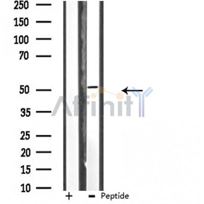 HUCE1 Antibody - Western blot analysis of extracts from MCF-7 cells, using HUCE1 antibody.