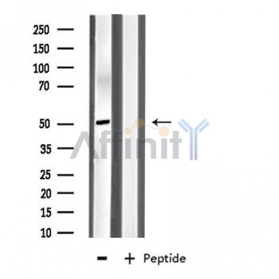 MYLIP Antibody - Western blot analysis of extracts from HeLa cells using MYLIP antibody.