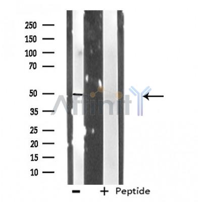 RNF14 Antibody - Western blot analysis of extracts from RAW264.