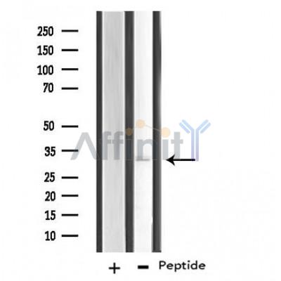 RNF144B Antibody - Western blot analysis of extracts from HeLa cells, using RNF144B antibody.