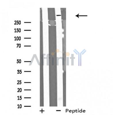 MYO9B Antibody - Western blot analysis of extracts from HeLa cells using MYO9B antibody.