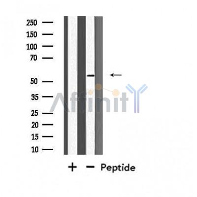 FOXD4 Antibody - Western blot analysis of extracts from NIH-3T3 cells, using FOXD4 antibody.