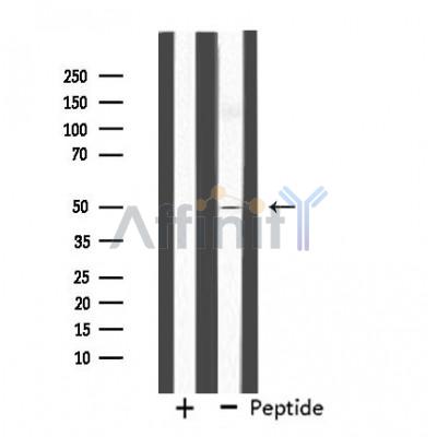 FOXN4 Antibody - Western blot analysis of extracts from LOVO cells, using FOXN4 antibody.