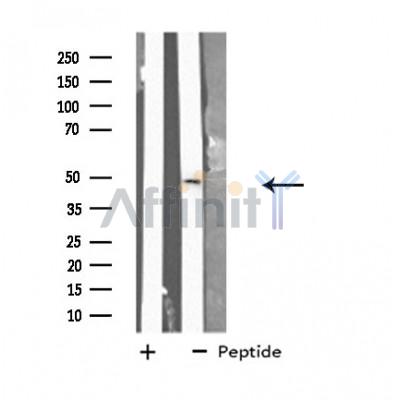 GJC2 Antibody - Western blot analysis of extracts from A549 cells, using CXG2 antibody.