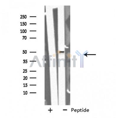 GORASP2 Antibody - Western blot analysis of extracts from HeLa cells using GORASP2 antibody.