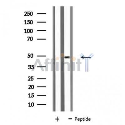 KCNN4 Antibody - Western blot analysis of extracts from HepG2 cells, using KCNN4 antibody.