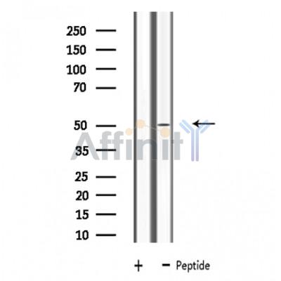 LRP11 Antibody - Western blot analysis of extracts from Jurkat cells, using LRP11 antibody.