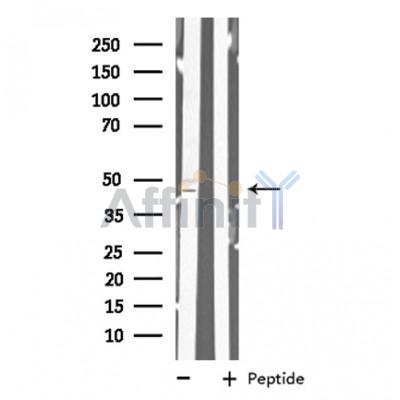MAD2L1BP Antibody - Western blot analysis of extracts from K562 cells, using MAD2L1BP antibody.