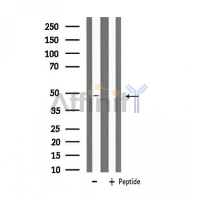 MRPS27 Antibody - Western blot analysis of extracts from HeLa cells using MRPS27 antibody.