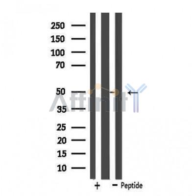 SLC16A3 Antibody - Western blot analysis of extracts from LOVO cells, using MOT4 antibody.