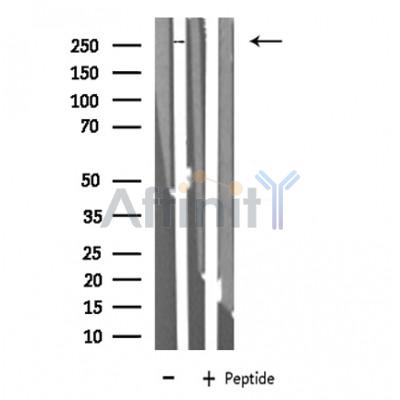 MEGF8 Antibody - Western blot analysis of extracts from COLO cells, using MEGF8 antibody.