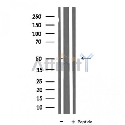 NBPF7 Antibody - Western blot analysis of extracts from HepG2 cells using NBPF7 antibody.