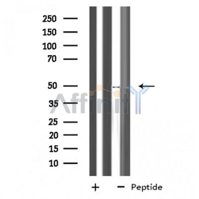 NLE1 Antibody - Western blot analysis of extracts from COS cells, using NLE1 antibody.