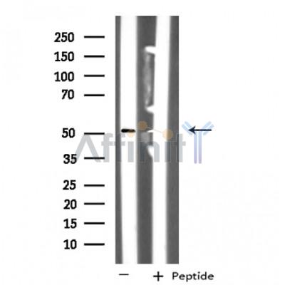 NUSAP1 Antibody - Western blot analysis of extracts from HT-29 cells, using NUSAP1 antibody.