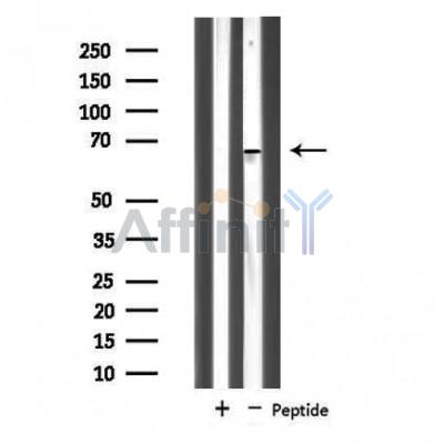 NOLC1 Antibody - Western blot analysis of extracts from K562 cells, using NOLC1 antibody.