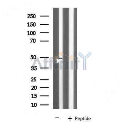 KCNK12 Antibody - Western blot analysis of extracts from Rat muscle, using KCNK12 antibody.