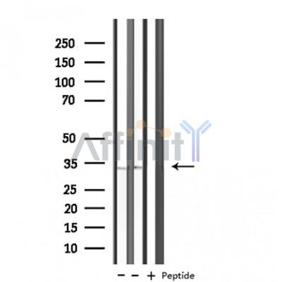 KCNK7 Antibody - Western blot analysis of extracts from Jurkat/293 cells, using KCNK7 antibody.