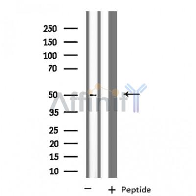 KCNG2 Antibody - Western blot analysis of extracts from COLO cells, using KCNG2 antibody.