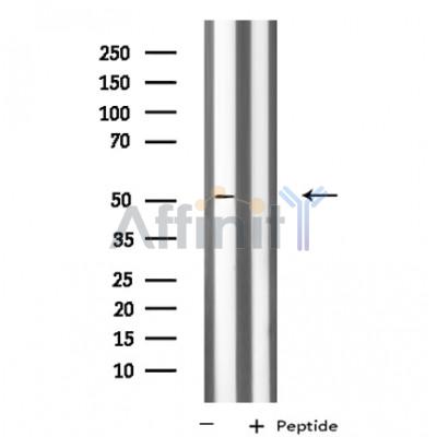 KCNG3 Antibody - Western blot analysis of extracts from MCF-7 cells, using KCNG3 antibody.