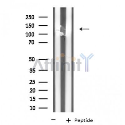 KCNH3 Antibody - Western blot analysis of extracts from HeLa cells, using KCNH3 antibody.