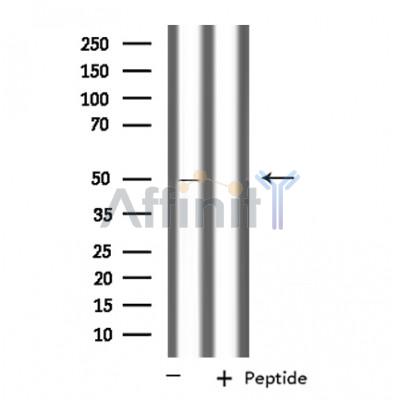 PPM1L Antibody - Western blot analysis of extracts from Jurkat cells, using PPM1L antibody.