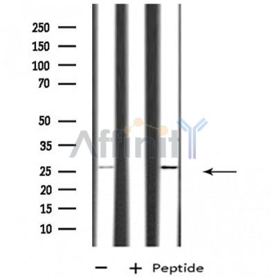 RAB26 Antibody - Western blot analysis of extracts from various samples, using RAB26 Antibody.