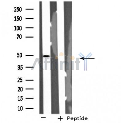 MST3 Antibody - Western blot analysis of extracts from COLO cells, using MST3 antibody.