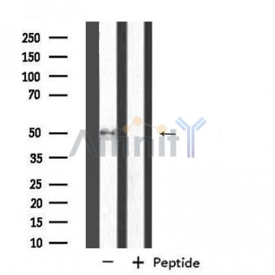 NIM1 Antibody - Western blot analysis of extracts from HepG2 cells using NIM1 antibody.
