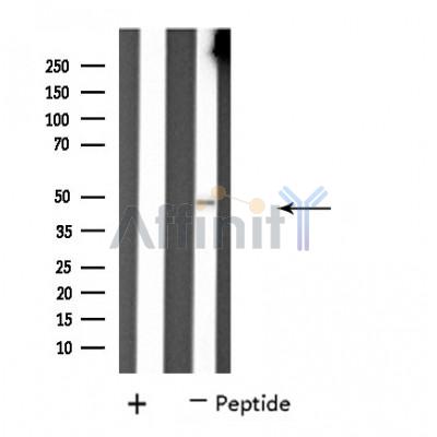 PPP4R2 Antibody - Western blot analysis of extracts from K562 cells using PP4R2 antibody.