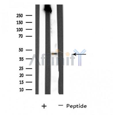 SERPINA11 Antibody - Western blot analysis of extracts from HT-29 cells, using SERPINA11 antibody.