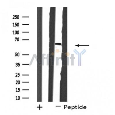 SH2B2 Antibody - Western blot analysis of extracts from HuvEc cells, using SH2B2 antibody.
