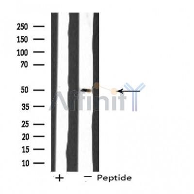 SH3GLB2 Antibody - Western blot analysis of extracts from COS cells, using SH3GLB2 antibody.