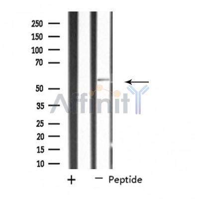 SHC2 Antibody - Western blot analysis of extracts from MCF-7 cells using SHC2 antibody.