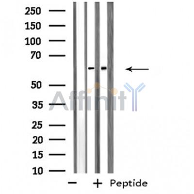SNX1 Antibody - Western blot analysis of extracts from Jurkat/293 cells, using SNX1 antibody.