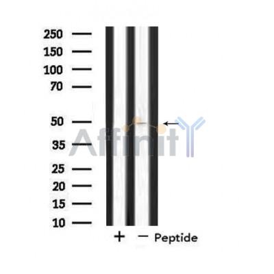 SYT11 Antibody - Western blot analysis of extracts from COLO205 cells, using SYT11 antibody.