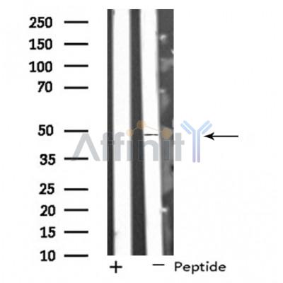 SYT13 Antibody - Western blot analysis of extracts from HuvEc cells, using SYT13 antibody.