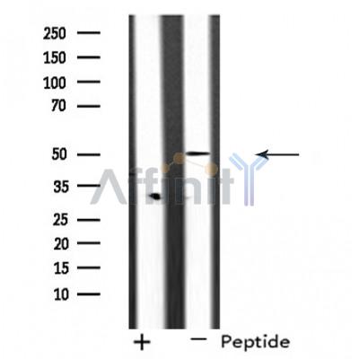 Rad51C Antibody - Western blot analysis of extracts from COS-7 cells, using RAD51L2 antibody.