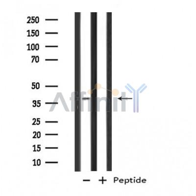 GTF3A Antibody - Western blot analysis of extracts from Jurkat cells, using GTF3A antibody.