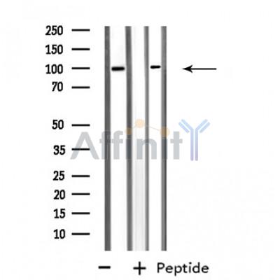 PTPN22 Antibody - Western blot analysis of extracts from HeLa/Jurkat cells, using PTPN22 antibody.
