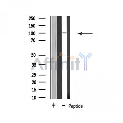 USP11 Antibody - Western blot analysis of extracts from 293 cells, using USP11 antibody.