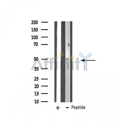 ZFYVE19 Antibody - Western blot analysis of extracts from HT-29 cells, using ZFYVE19 antibody.